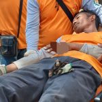 PLN Bungkam, Pekerjanya Tersengat Listrik Hingga Tangan Melepuh