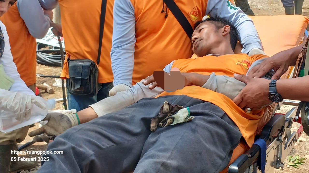 PLN Bungkam, Pekerjanya Tersengat Listrik Hingga Tangan Melepuh