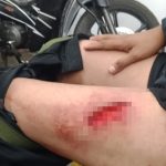 Wartawan di Cianjur Dibacok, Diduga Akibat Kesalahpahaman