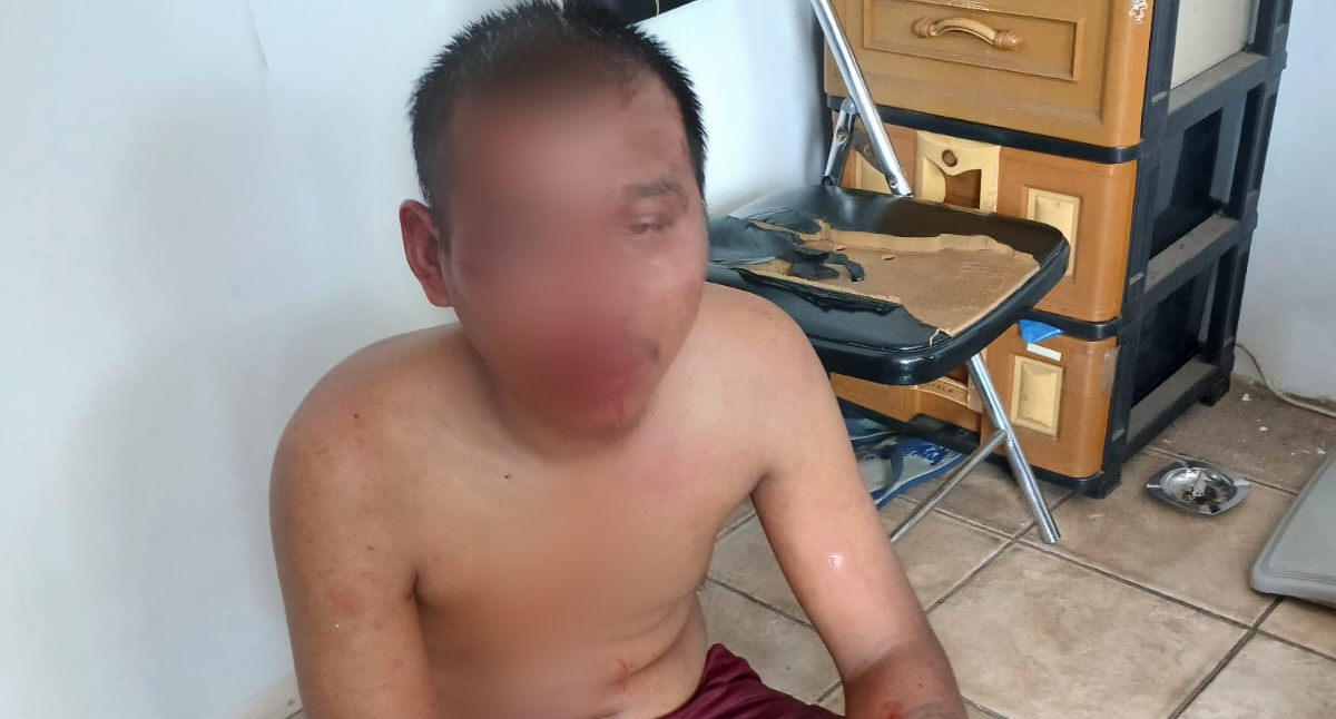 Pelaku Curanmor di Cianjur Kena Hujanan Bogem Mentah Usai Gagal Beraksi