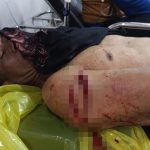 Kera Liar Serang Warga Cibeber, Tiga Orang Terluka