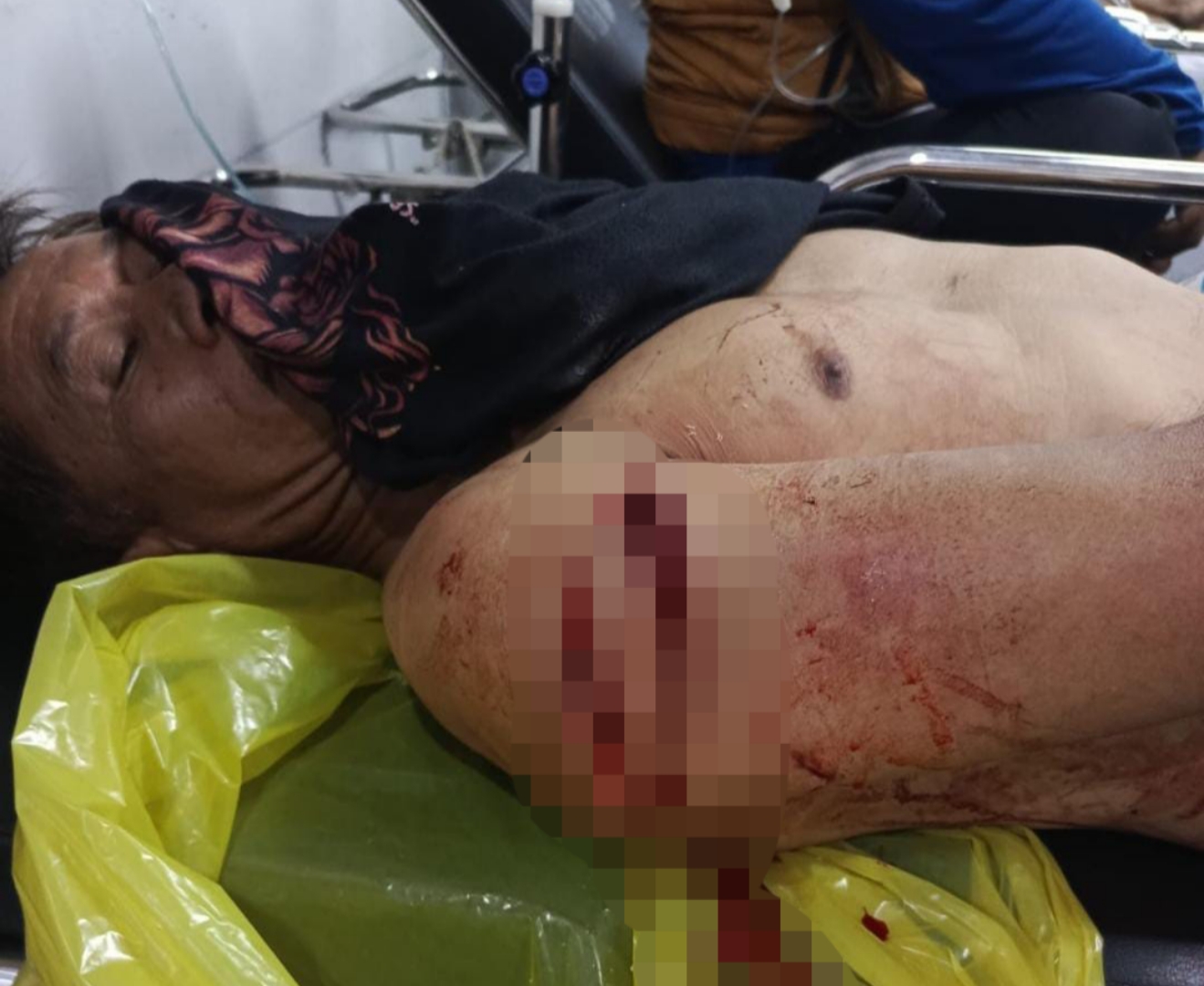 Kera Liar Serang Warga Cibeber, Tiga Orang Terluka