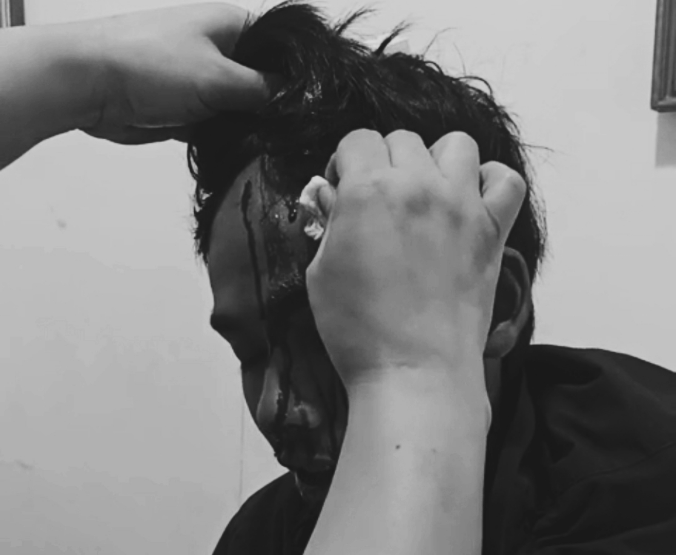 Kurir Paket Dikeroyok Saat Antar Ulang Pesanan di Pasirkuda Cianjur, Korban Luka Parah di Kepala